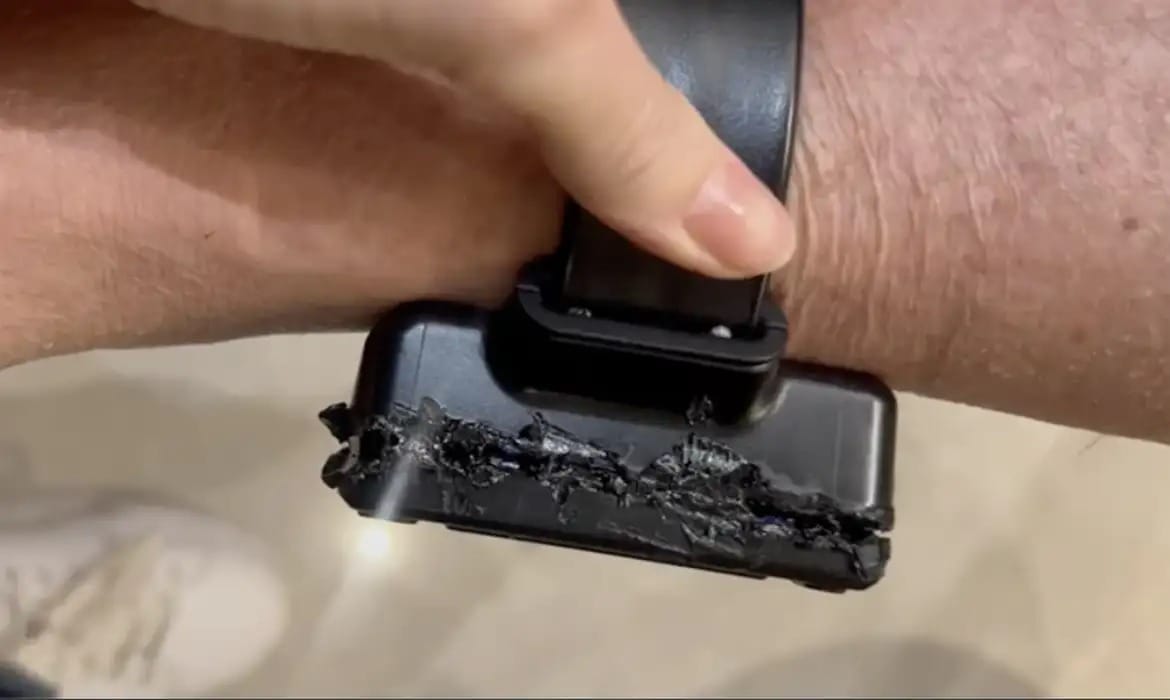 Bolsonaro usou solda para tentar abrir tornozeleira